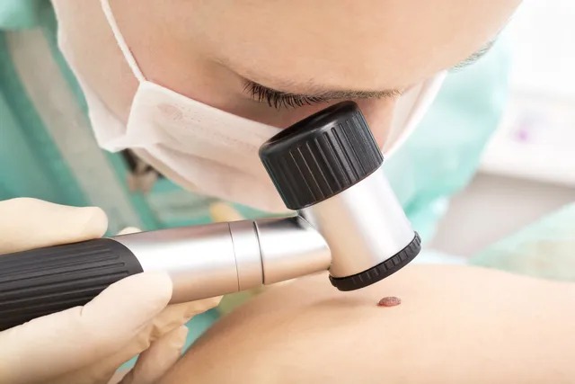 Leia mais sobre o artigo Dermatologia – especialidade médica oferecida pela Aciap aos associados